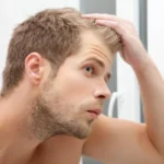 Homem preocupado observando a queda de cabelo masculina no espelho