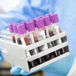 exames laboratoriais com tubos de sangue em laboratório clínico