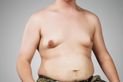 Proteína de soja causa ginecomastia?
