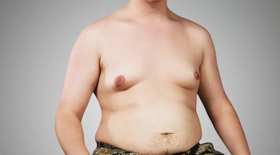 Proteína de soja causa ginecomastia?